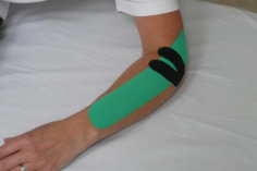 Kinesiotaping