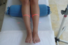 Lasertherapie